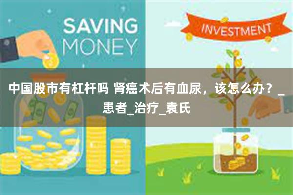 中国股市有杠杆吗 肾癌术后有血尿，该怎么办？_患者_治疗_袁氏